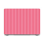 Perfect Stripes | Pink Stripes Laptop Shell