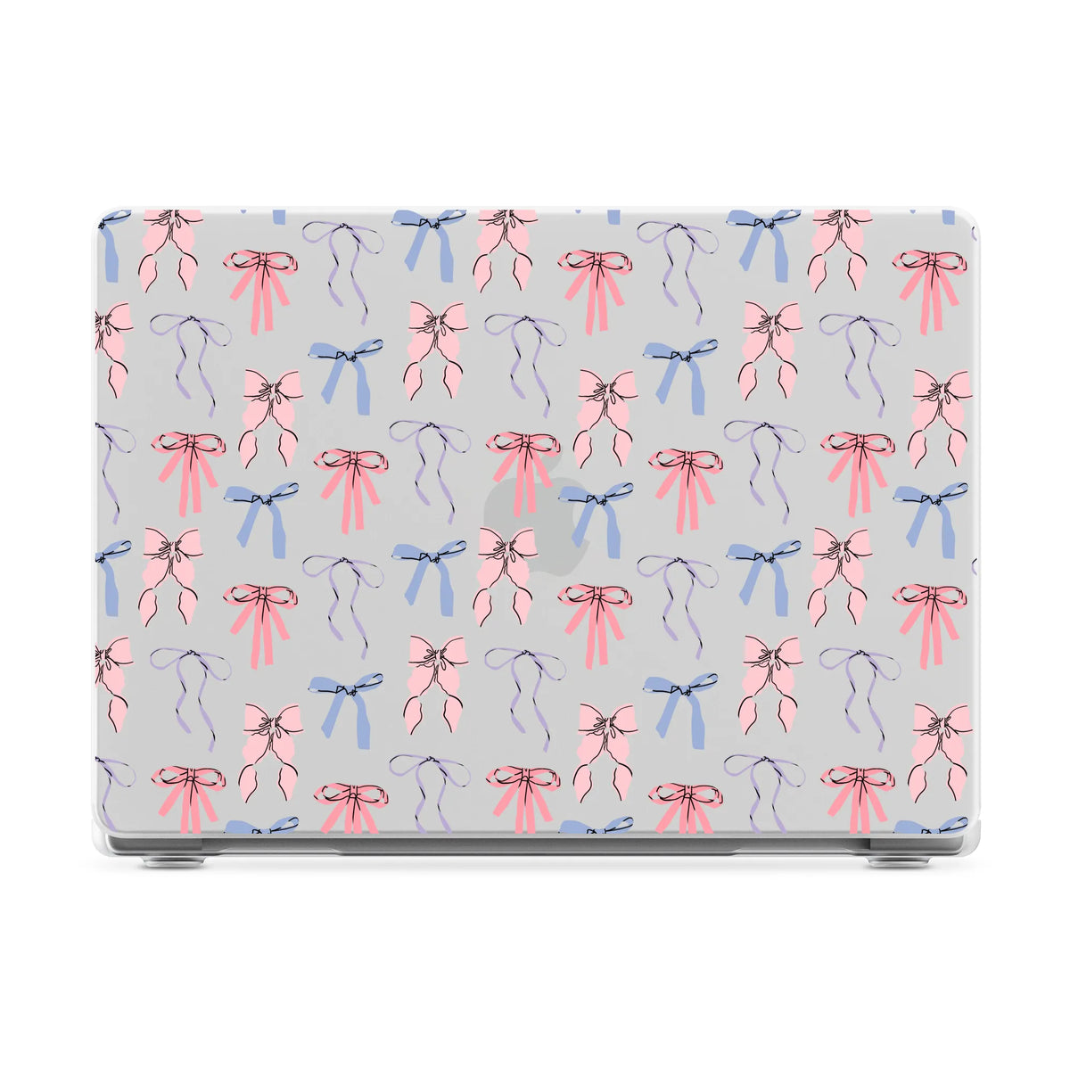 Coquette Girlie | Pastel Bows Laptop Shell