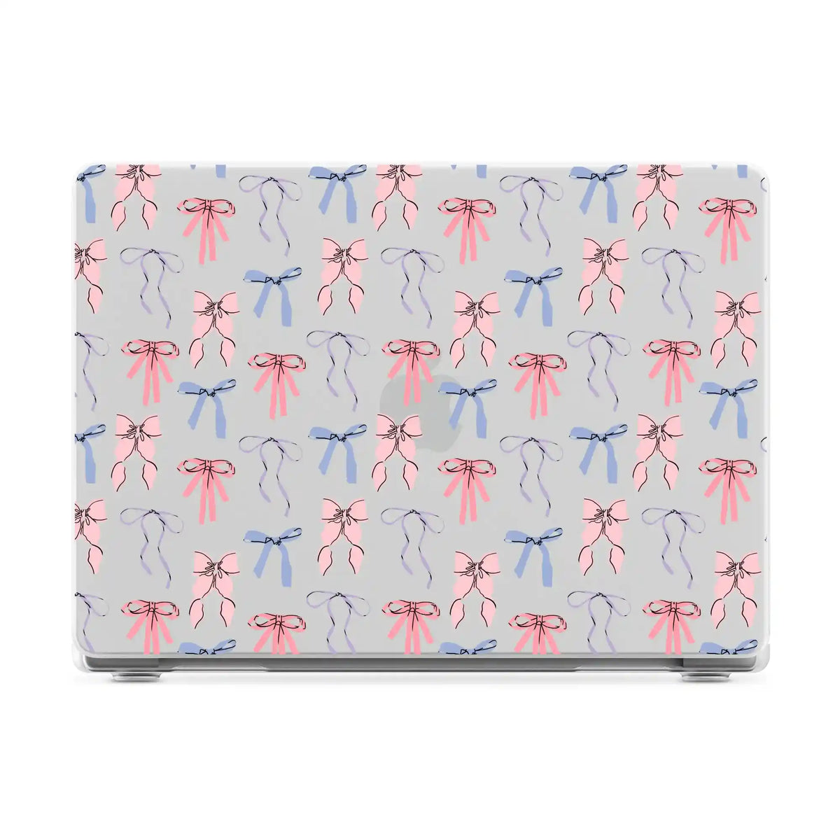 Coquette Girlie | Pastel Bows Laptop Shell